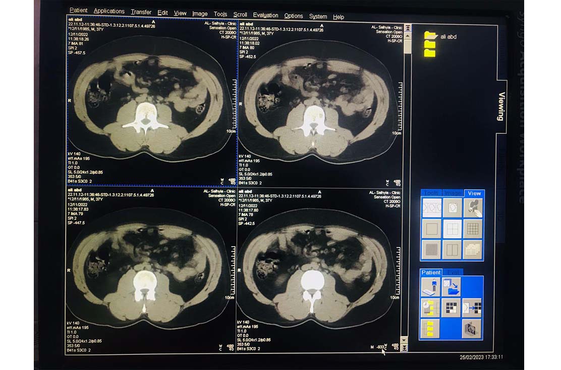 CT-scan-siemens-somatom-sensation-40-slic