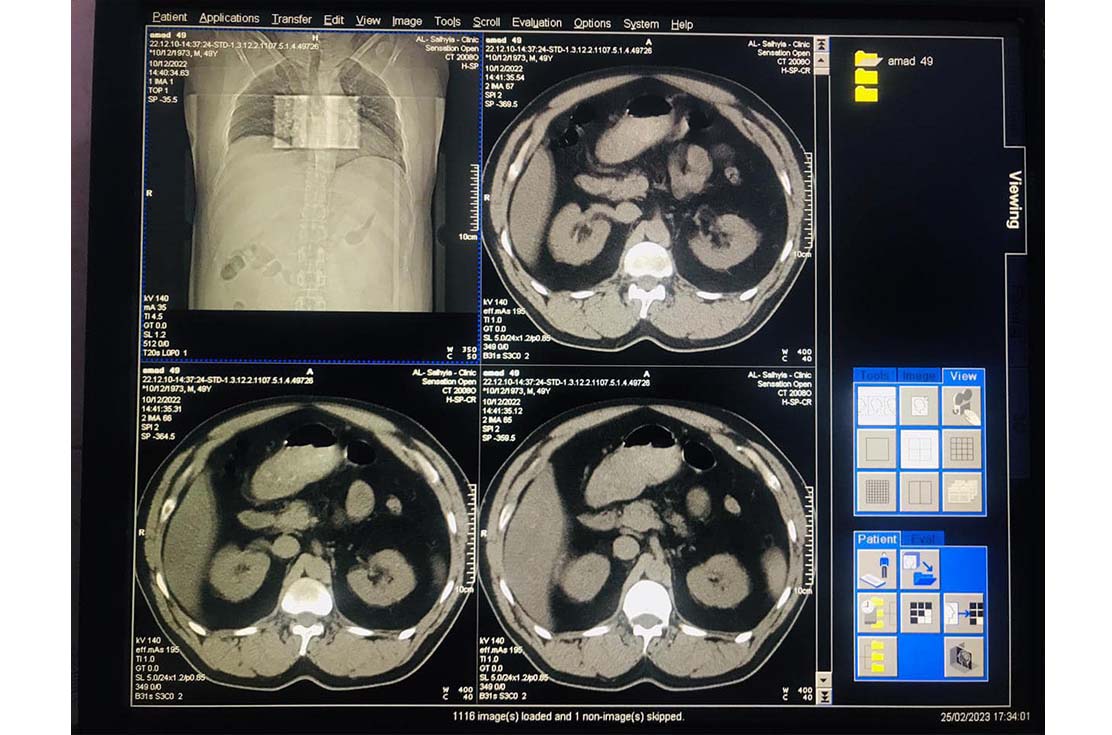 CT-scan-siemens-somatom-sensation-40-slic